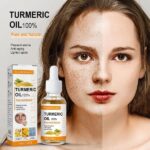 Turmeric-Freckle-Serum-Whitening-Dark